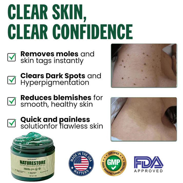 LOVILDS® Instant Mole & Spot Gel