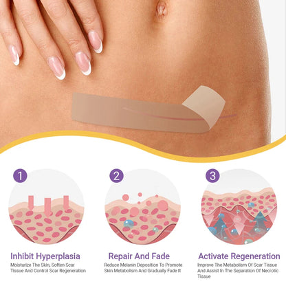 Juxek® Hyaluronic Acid Nano Microneedle Repair Tape